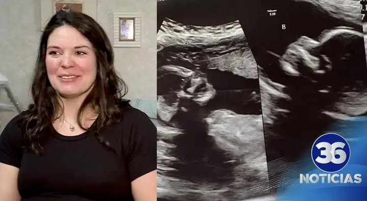 Embarazo Único Kelsey Hatcher Espera Gemelas en Alabama